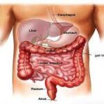 10 Ways To Prevent Gastrointestinal Surgery